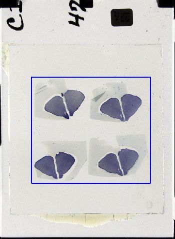 Media type: image; Special Collections 3298   shows specimen_part histological serial section;
